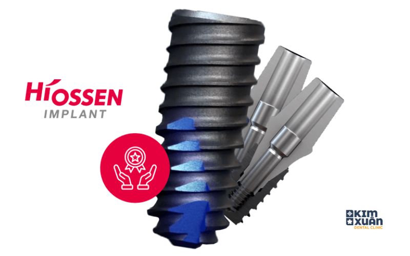 Ưu Điểm Của Trụ Implant Hiossen