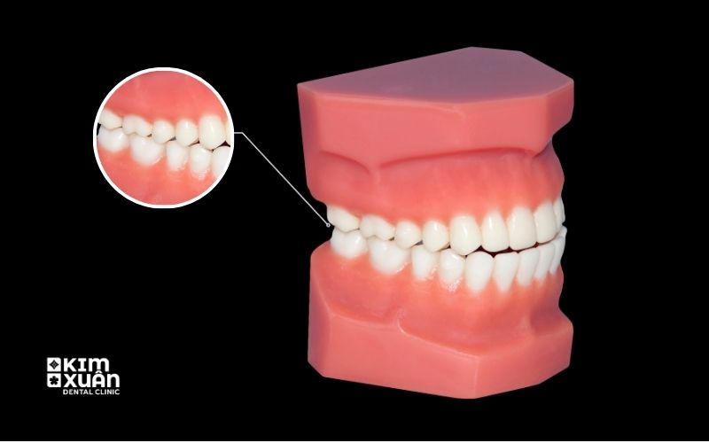 Vai Trò Của Răng Cấm