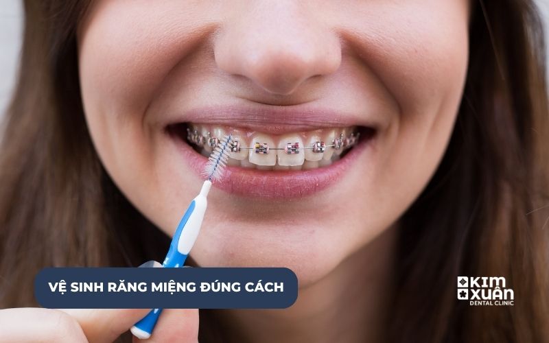 Vệ Sinh Răng Miệng Đúng Cách