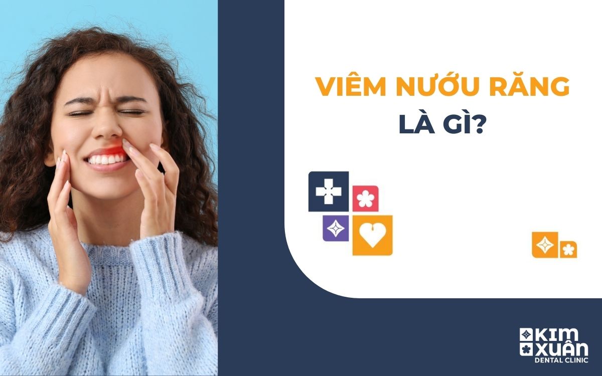 Viêm Nướu Răng Là Gì?